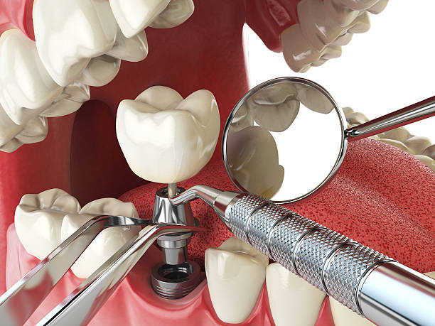 Best Emergency Treatment for Toothache in Kellyville, OK
